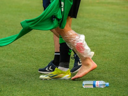 Isco se retira del terreno de juego luego de fracturarse el peroné en el partido jugado por el Betis en Las Palmas el pasado curso.